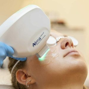 IPL LASER TREATMENT (HALE MODEL)