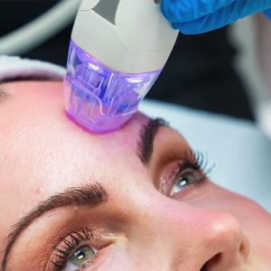 RADIO FREQUENCY AND MICRONEEDLING COURSE